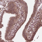Immunohistochemical staining of human fallopian tube shows moderate cytoplasmic and nuclear positivity in glandular cells.