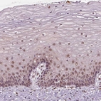 Immunohistochemical staining of human cervix, uterine shows moderate nuclear positivity in squamous epithelial cells.