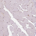 Immunohistochemical staining of human skeletal muscle shows weak nuclear positivity in myocytes.