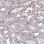 Immunohistochemical staining of human kidney shows weak cytoplasmic positivity in cells in tubules.