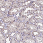 Immunohistochemical staining of human kidney shows weak cytoplasmic positivity in cells in tubules.