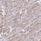 Immunohistochemical staining of human heart muscle shows moderate cytoplasmic positivity in cardiomyocytes.