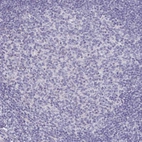 Immunohistochemical staining of human tonsil shows no positivity in germinal center cells as expected.