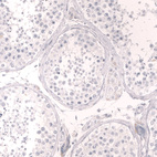 Anti-TNNT2 Antibody