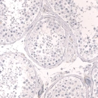 Immunohistochemical staining of human testis shows no positivity in cells in seminiferous ducts as expected.