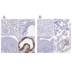 Anti-DPEP3 Antibody