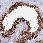 Immunohistochemical staining of human testis shows strong cytoplasmic and membranous positivity in cells in seminiferous ducts.