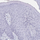 Immunohistochemical staining of human skin shows no positivity in squamous epithelial cells as expected.