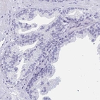 Immunohistochemical staining of human prostate shows no positivity in glandular cells as expected.