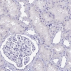 Immunohistochemical staining of human kidney shows no positivity in cells in tubules as expected.