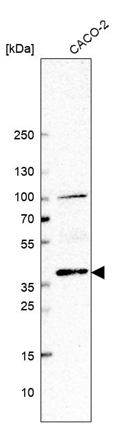 Anti-BMP2 Antibody