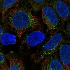 Immunofluorescent staining of human cell line RT4 shows localization to vesicles.