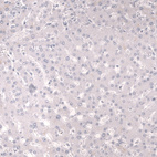 Anti-TNNT2 Antibody