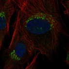 Anti-TNFRSF11B Antibody