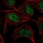 Anti-GUCY1A3 Antibody