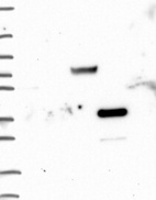 Anti-GPD1 Antibody