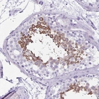 Immunohistochemical staining of human testis shows high expression.