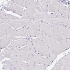 Immunohistochemical staining of human skeletal muscle shows low expression as expected.