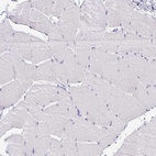 Anti-CLGN Antibody