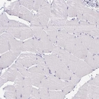 Immunohistochemical staining of human skeletal muscle shows low expression as expected.