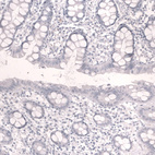 Anti-TNNT2 Antibody