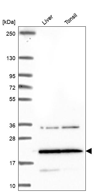 Anti-TM4SF18 Antibody