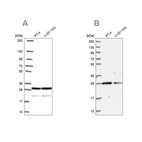 Anti-PGRMC2 Antibody