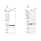 Western blot analysis using Anti-PGRMC2 antibody HPA058652 (A) shows similar pattern to independent antibody HPA041172 (B).
