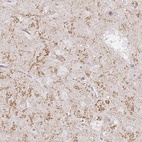 Anti-GRIA3 Antibody