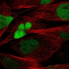 Anti-SOX8 Antibody