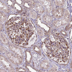 Immunohistochemical staining of human kidney shows moderate cytoplasmic positivity in cells in glomeruli.