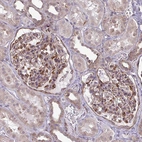 Immunohistochemical staining of human kidney shows moderate cytoplasmic positivity in cells in glomeruli.