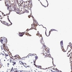 Immunohistochemical staining of human lung shows moderate cytoplasmic positivity in macrophages.