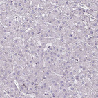 Immunohistochemical staining of human liver shows no positivity in hepatocytes as expected.