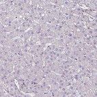Immunohistochemical staining of human liver shows no positivity in hepatocytes as expected.