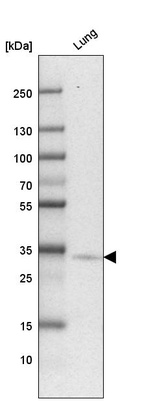 Western blot analysis in human lung tissue.