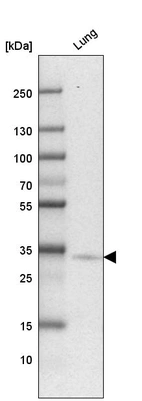 Western blot analysis in human lung tissue.