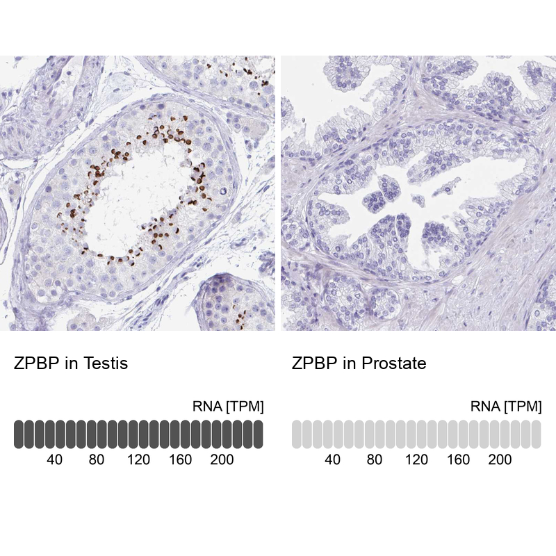 Anti-ZPBP Antibody