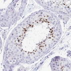 Immunohistochemical staining of human Testis shows strong cytoplasmic positivity in acrosomal caps in cells in seminiferous ducts.