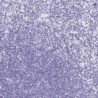 Immunohistochemical staining of human Tonsil shows no positivity in non-germinal center cells as expected.