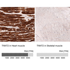 Anti-TNNT2 Antibody