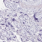 Immunohistochemical staining of human Placenta shows no positivity in trophoblastic cells as expected.
