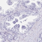 Immunohistochemical staining of human Prostate shows no positivity in glandular cells as expected.