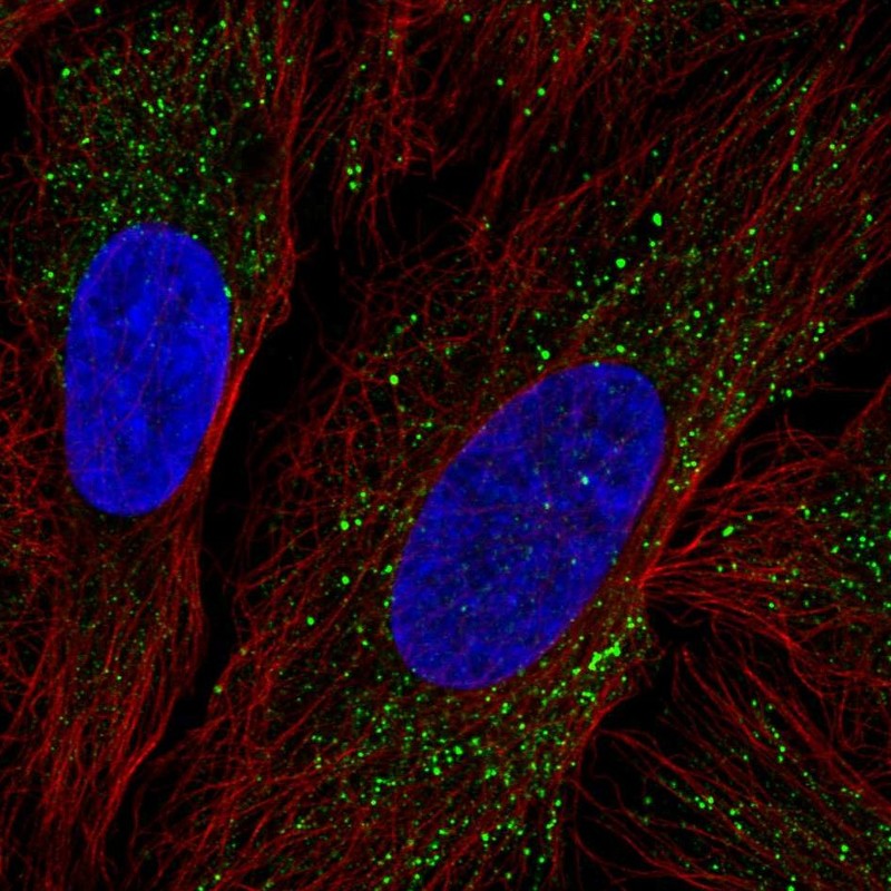 Anti-ZDHHC17 Antibody