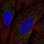 Anti-ZDHHC17 Antibody