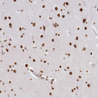 Anti-HNRNPU Antibody