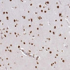 Anti-HNRNPU Antibody
