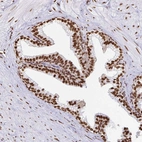 Immunohistochemical staining of human prostate shows strong nuclear positivity in glandular cells.