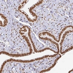 Immunohistochemical staining of human Fallopian tube shows strong nuclear positivity in glandular cells.
