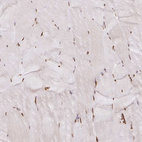 Immunohistochemical staining of human skeletal muscle shows moderate nuclear positivity in myocytes.